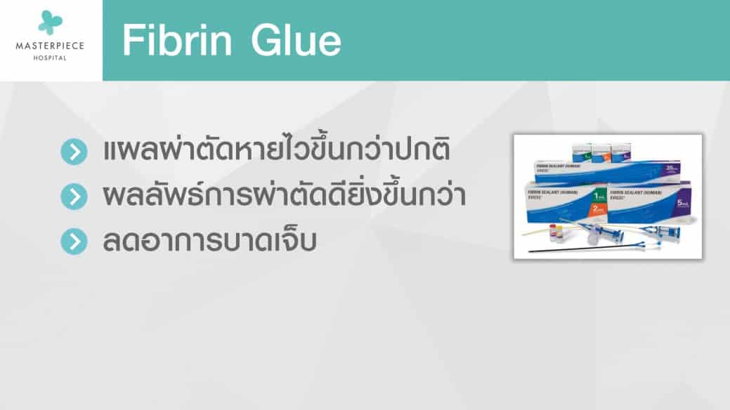 ไฟบริน Fibrin Masterpiece Hospital
