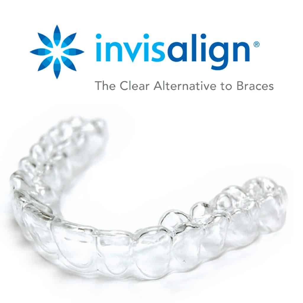 การจัดฟันแบบใสถอดได้ Invisalign