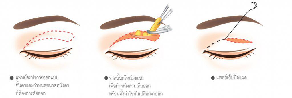 ตาสองชั้น