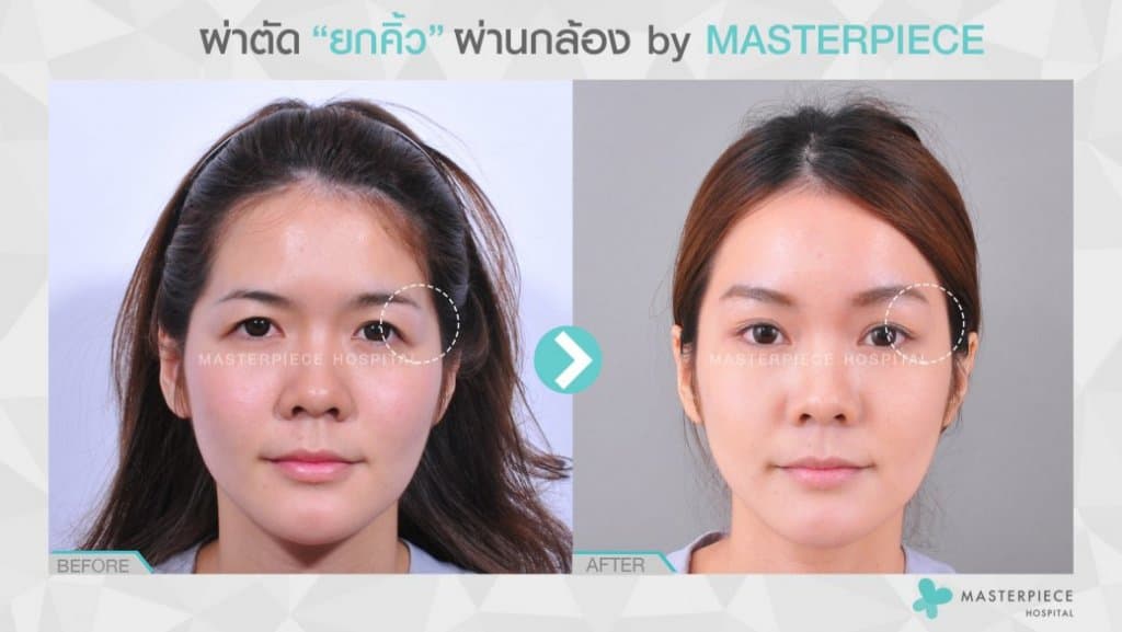 BA ยกคิ้ว 02
