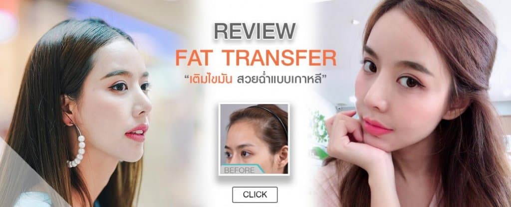 รีวิวฉีดไขมันหน้าเด็ก Fat Transfer