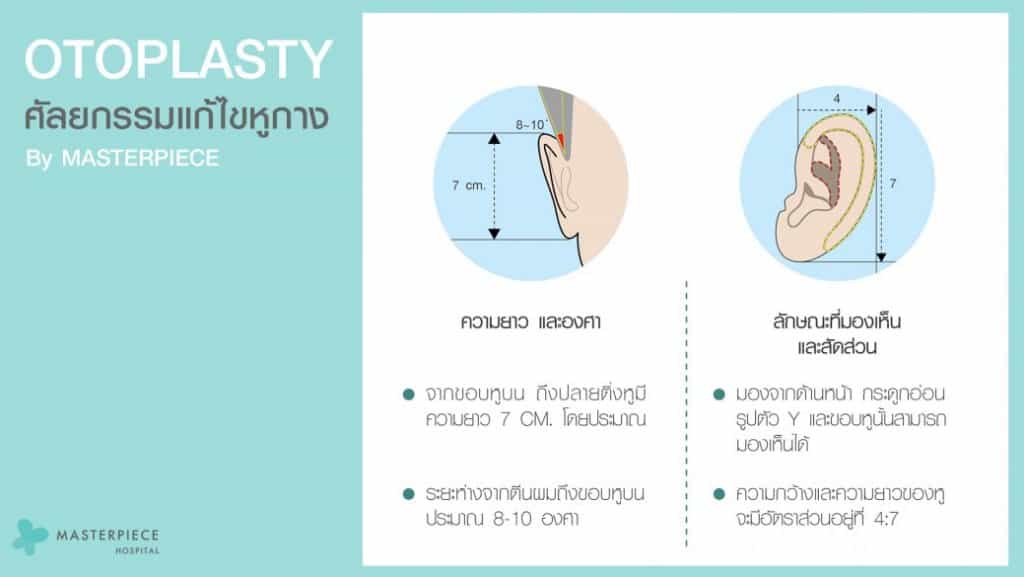 ศัลยกรรมแก้หูกาง