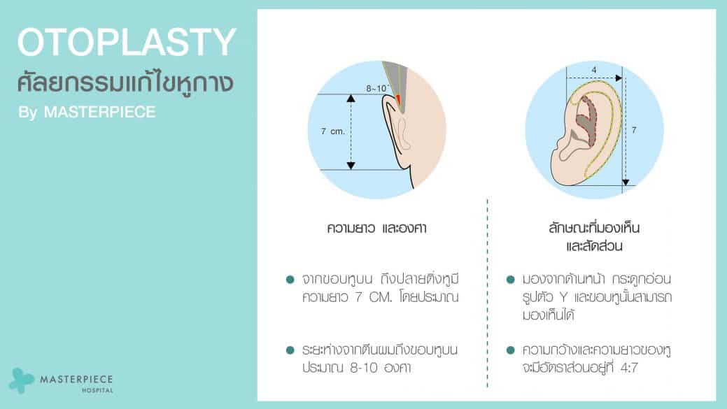 ศัลยกรรมแก้ไขหูกาง