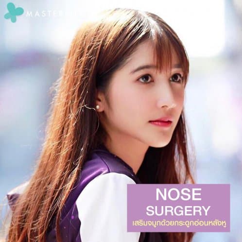 รีวิว เสริมจมูกด้วยกระดูกอ่อนหลังหู