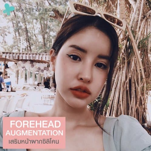 เสริมหน้าผากซิลิโคน