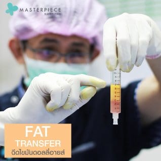ฉีดไขมันดอลลี่อาย Fat Transfer