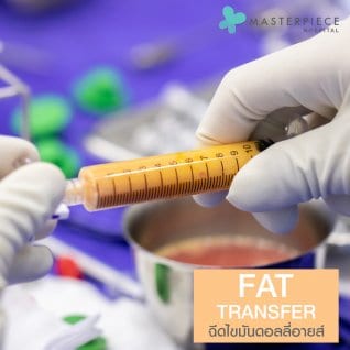 การฉีดไขมันดอลลี่อาย Fat Transfer
