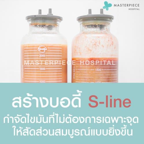 ถังไขมัน