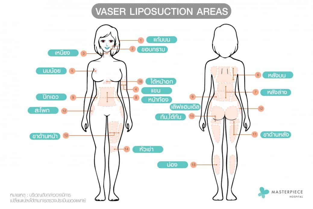 ดูดไขมัน vaser