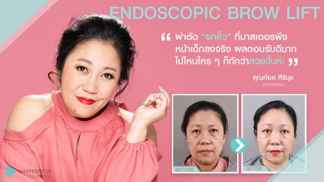 ก้อยรีวิว
