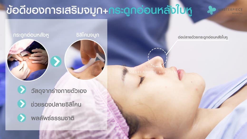 ข้อดี เสริมจมูกด้วยกระดูกอ่อนหลังหู