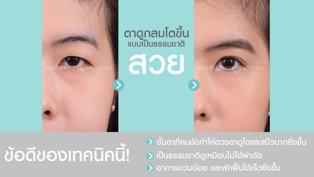 ตาสองชั้น