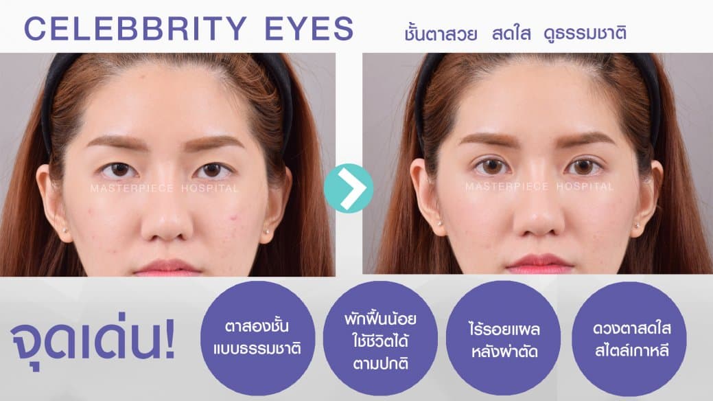 จุดเด่นของการทำตาด้วยเทคนิค CELEBRITY EYES