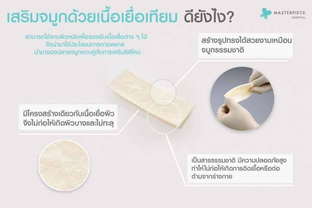 เสริมจมูกเนื้อเยื่อเทียม ดียังไง?