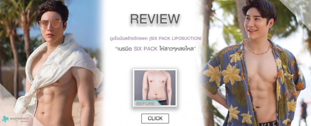 รีวิวการดูดไขมันซิกแพค
