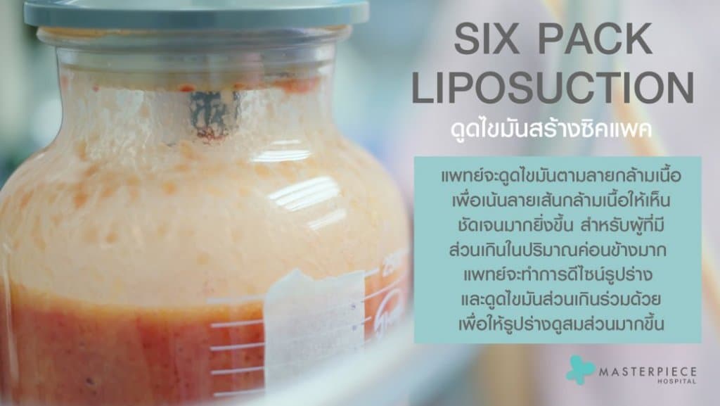 การจัดการไขมัน