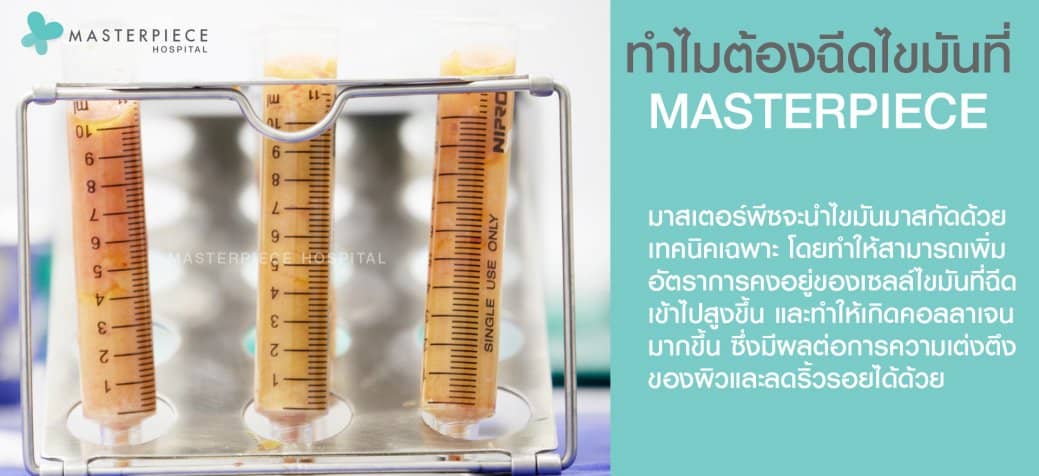 ทำไมต้องฉีดไขมันที่ MASTERPIECE