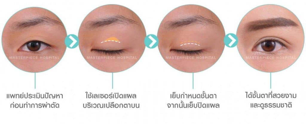 ตาสองชั้น