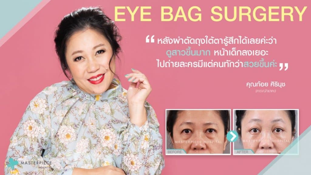 รีวิว กำจัดถุงใต้ตา
