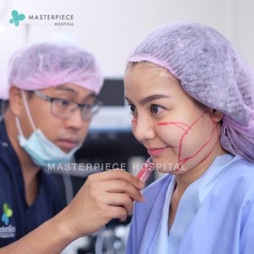 ดูดไขมันหน้า Facial Vaser Liposuction