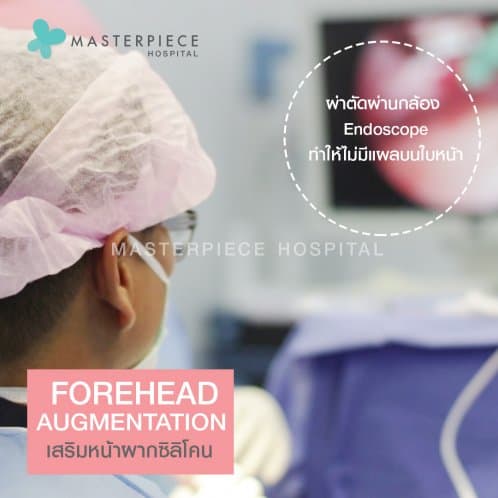 เสริมหน้าผากซิลิโคน