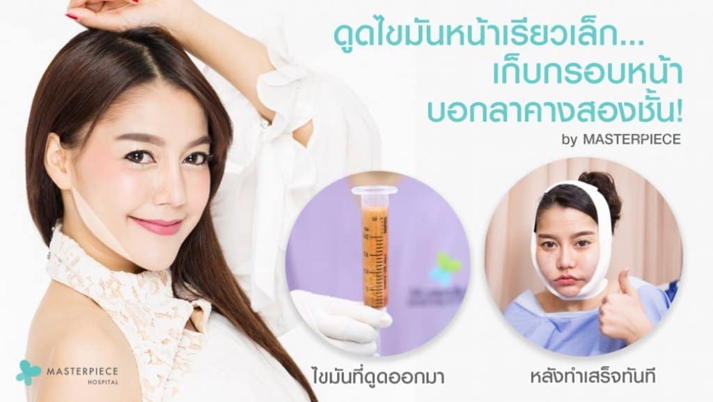 ดูดไขมันหน้า