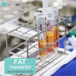 หลอดไขมัน Fat Transfer