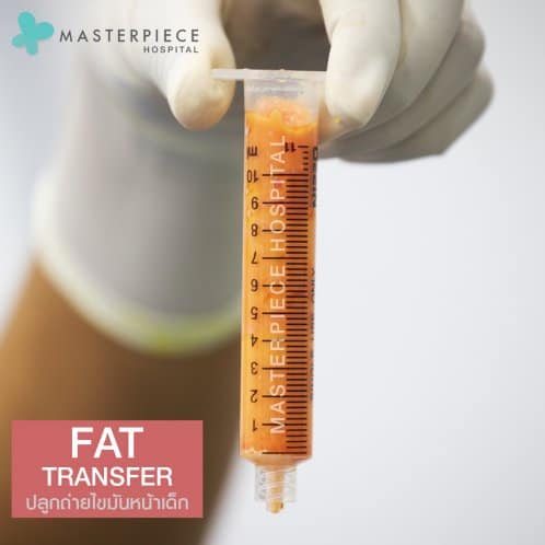 Fat Stem Cells