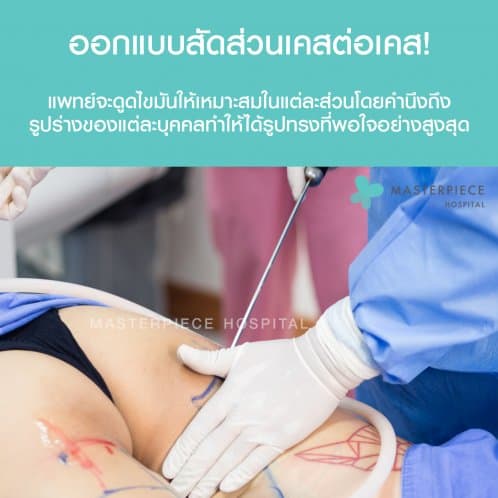 ดูดไขมัน ตัว VASER LIPOSUCTION