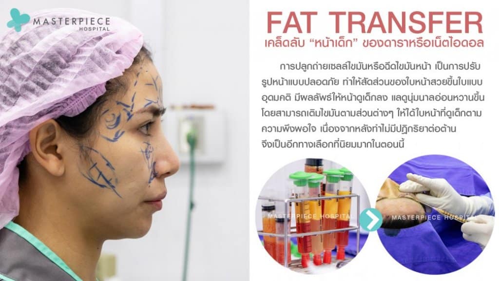 เคล็ดลับฉีดไขมันหน้าเด็ก Fat Transfer