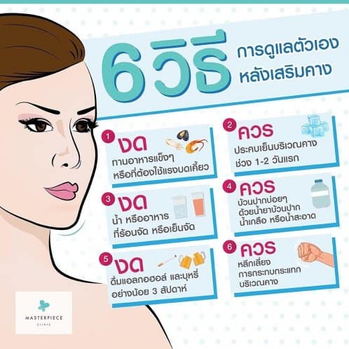 6 วิธีการดูแลตัวเองหลังเสริมคา