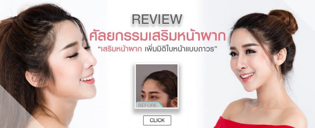 รีวิว เสริมหน้าผากซิลิโคน