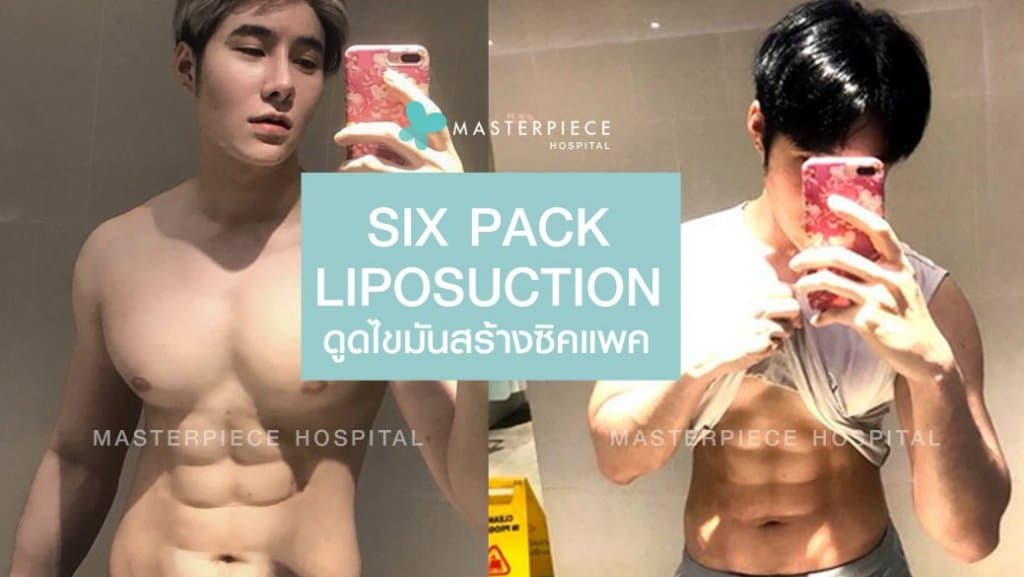 รูปก่อน-หลัง ดูดไขมัน