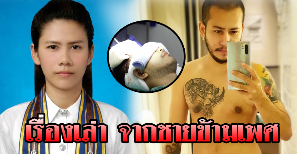 เรื่องเล่า จากชายข้ามเพศ