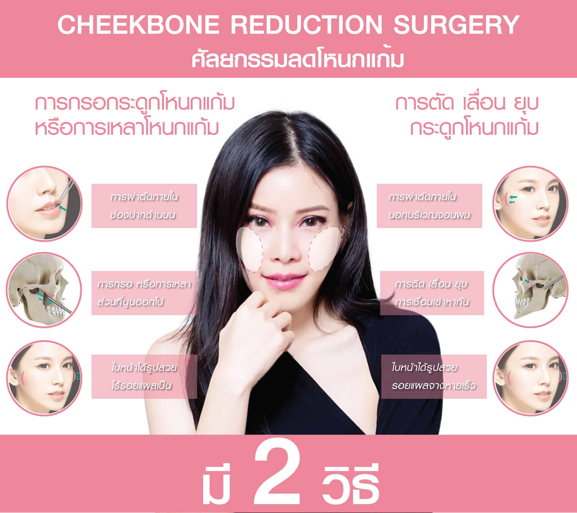 การกรอโหนกแก้มและผ่าตัดยุบโหนกแก้มต่างกันอย่างไร ?