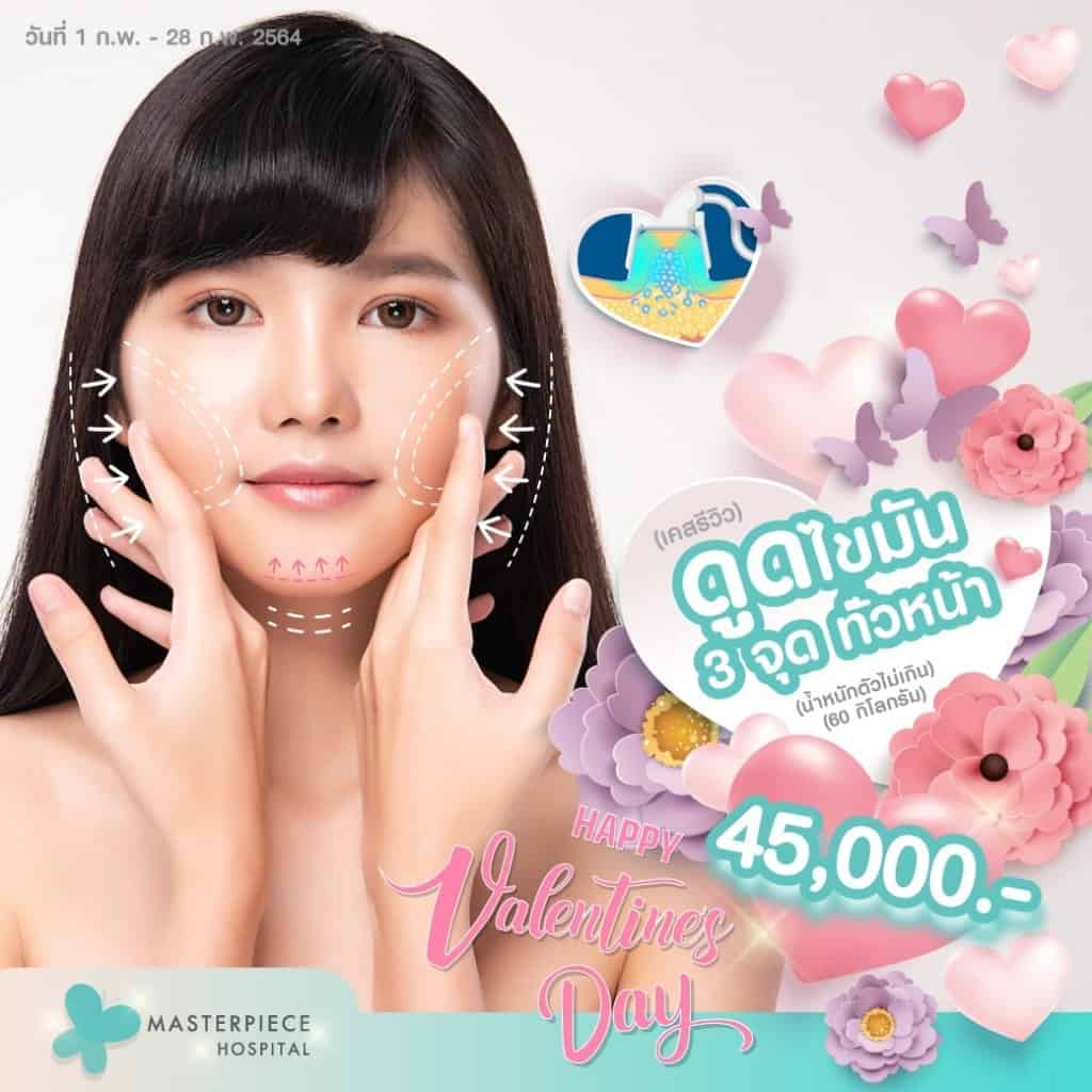 Promotion ดูดไขมันหน้า