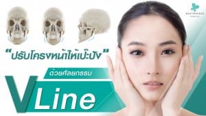 ปรับโครงหน้า Vline