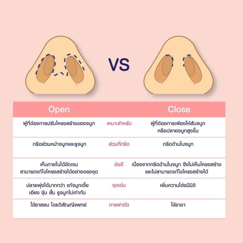 จมูกโอเพ่น