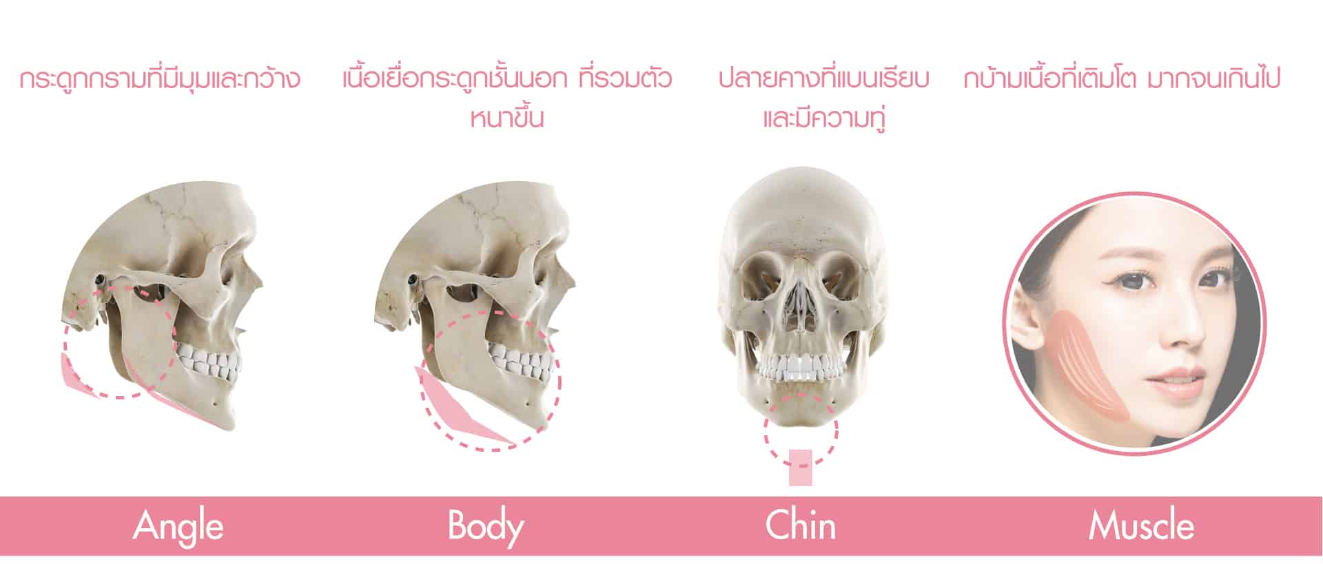 ทุบโหนก ตัดกราม มาสเตอร์พีช