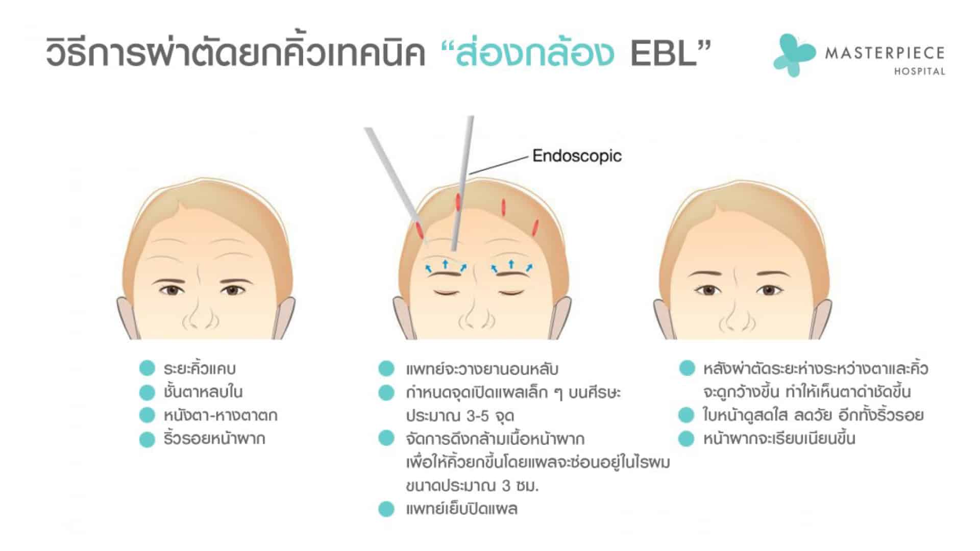 เทคนิคใหม่ “ยกคิ้วผ่านกล้อง”