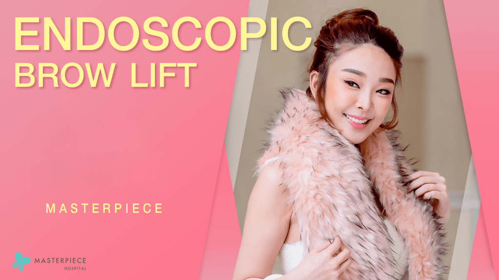 ยกคิ้ว (Endoscopic Brow Lift)