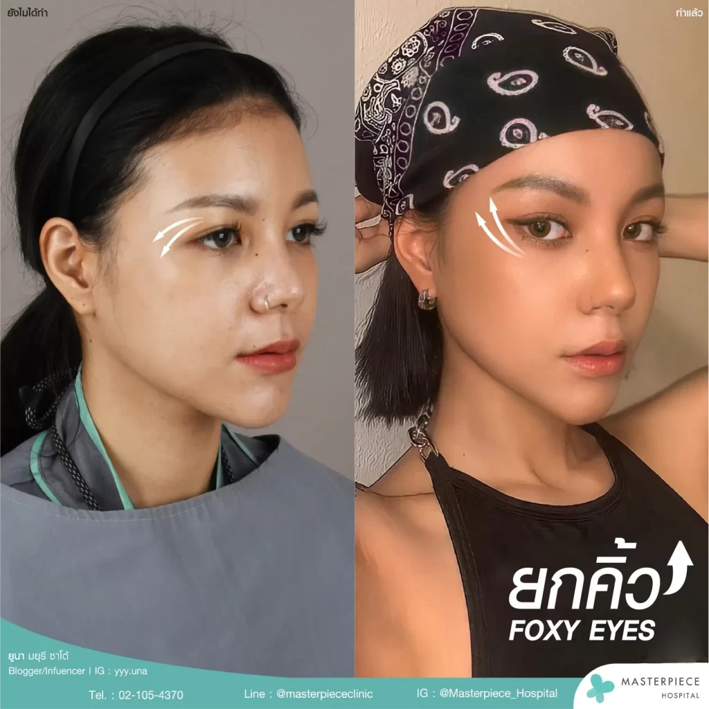 FOXY EYES คืออะไร ?