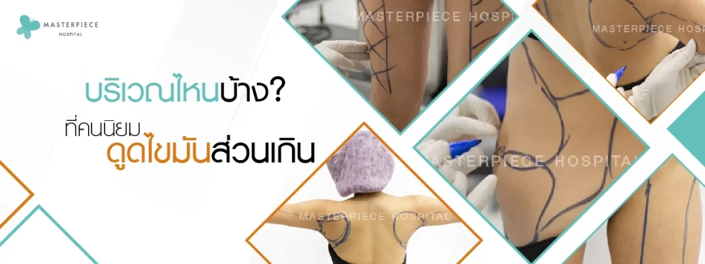 บริเวณไหนบ้าง ที่คนนิยมดูดไขมันส่วนเกิน 1200p