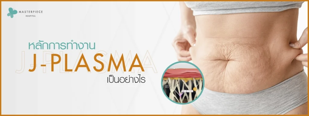 หลักการทำงานของ J PLASMA เป็นอย่างไร
