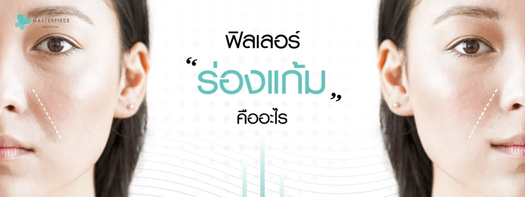 ฟิลเลอร์ร่องแก้มคืออะไร