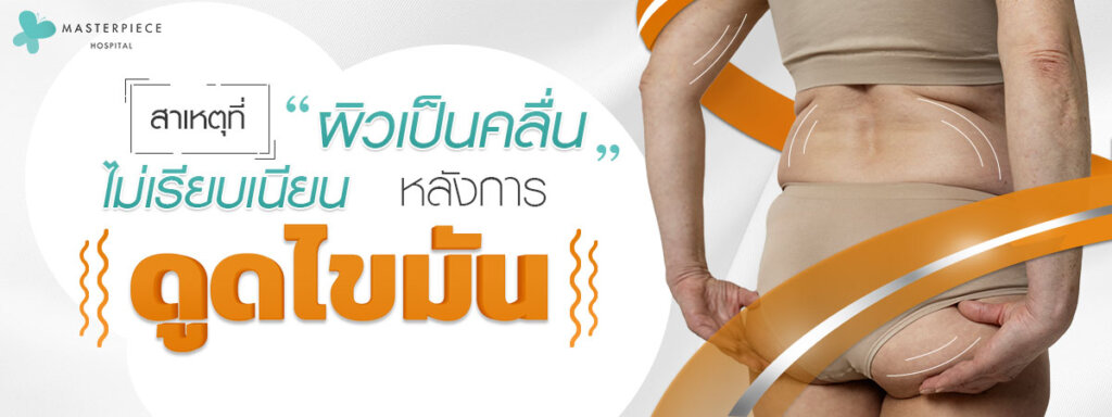 สาเหตุที่ผิวเป็นคลื่น ไม่เรียบเนียนหลังการดูดไขมัน