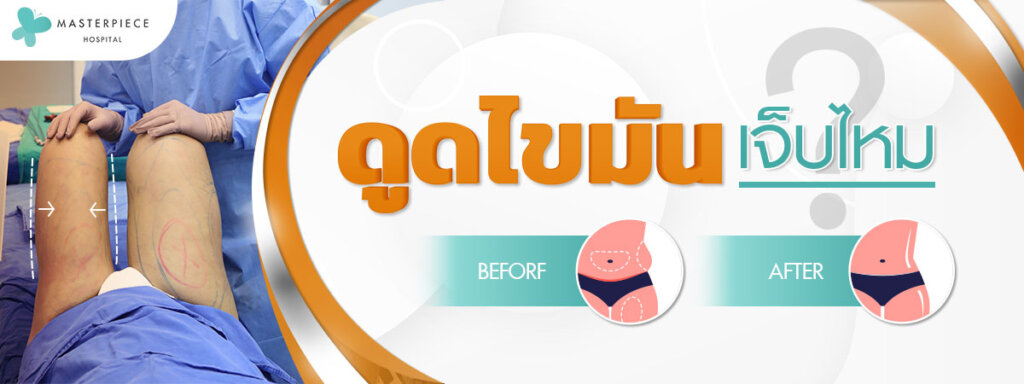 ดูดไขมันเจ็บมั้ย ?