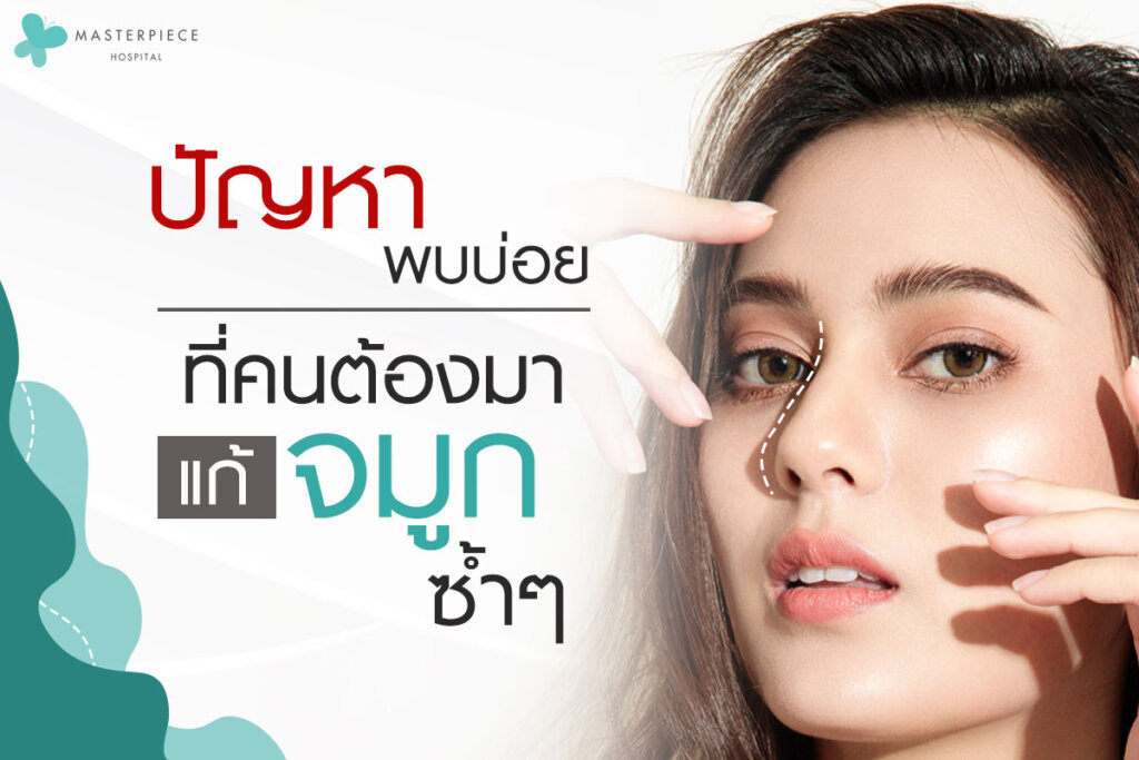 ปัญหาพบบ่อย ที่คนต้องมาแก้จมูกซ้ำๆ