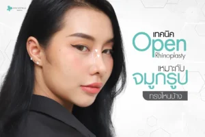 เทคนิค Open นี้ … เหมาะกับจมูกรูปทรงไหนบ้าง