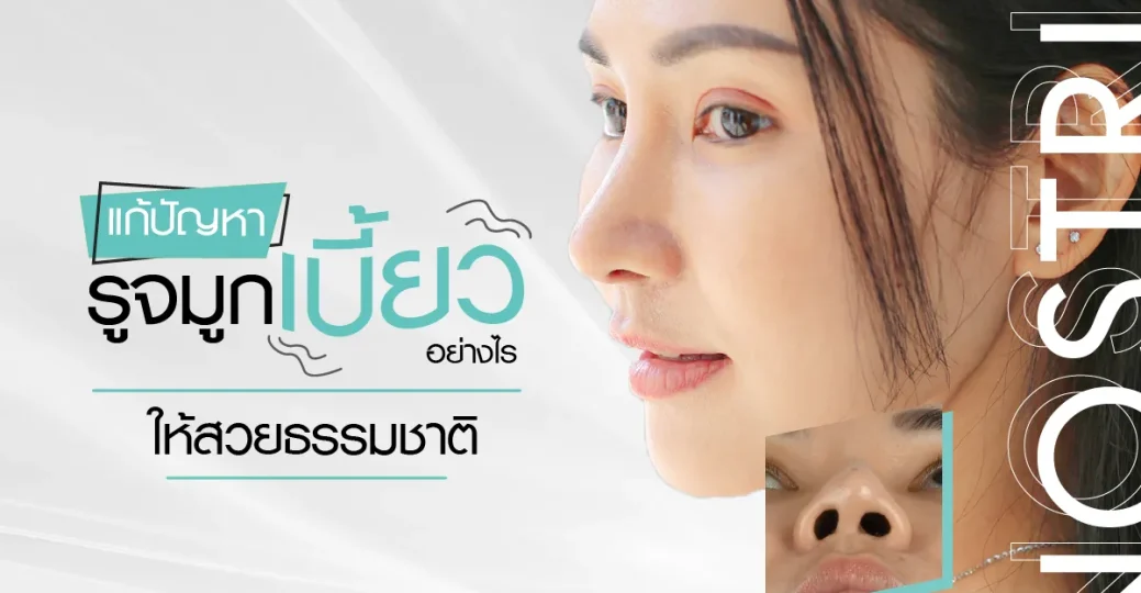 แก้ปัญหารูจมูกเบี้ยวอย่างไร ให้สวยเป็นธรรมชาติ